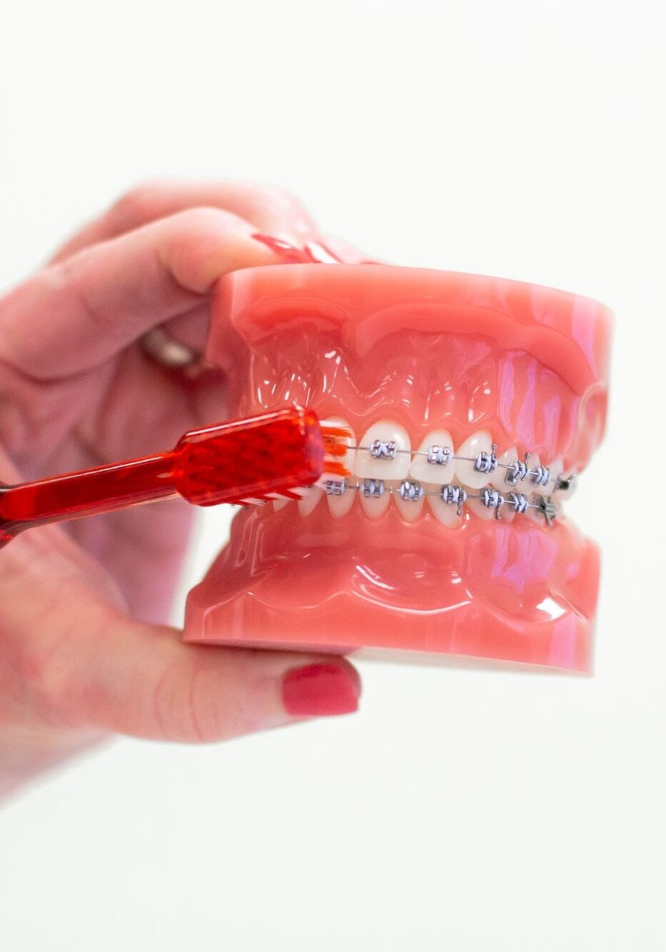 IMG_5931 framingham braces